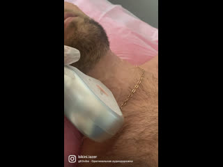 best видео от bikinilazer лазерная эпиляция в самаре best