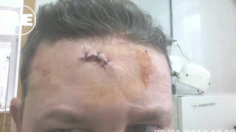 best неадекватный житель снт ручеек в люберцах избил председателя правления за неверный счет за свет best