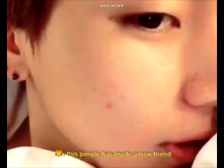 best everyone this is my new friend a pimple it will stay with me for about a week please give it a lot of love tae best