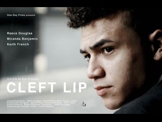 best заячья губа cleft lip 2018 великобритания best
