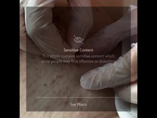 best впечатлительным не смотреть любите свою зону бикини приходите к нам на лазерную эпиляцию и у вас всегда будет best