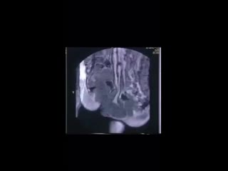 best секс во время мрт необычный эксперимент проведенный 20 лет назад доктором тони деламотом опубликован в bmj best