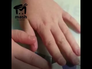 best в ялте люди жалуются на странные ожоги от водопроводной воды best
