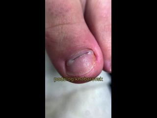 best видео от pedicure journal идеи педикюра подология best