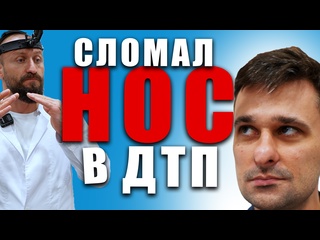 best авария унесла нос а мы его вернули на место риносептопластика в махачкале ринопластика best
