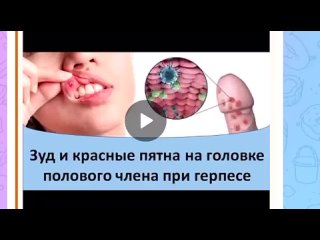 best зуд и красные пятна на голое полового члена при герпесе best