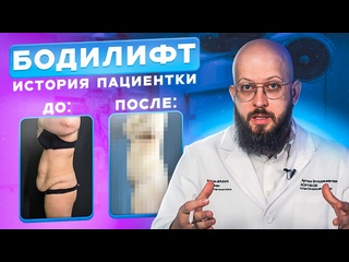 best невероятная трансформация бодилифт и липосакция best