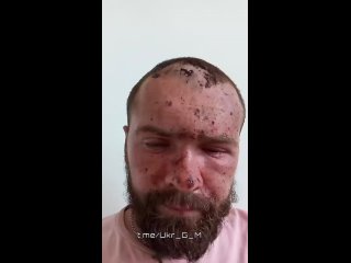 best брошенный на произвол судьбы после ранения боевик вынужден просить помощи у сограждан так как использованный best