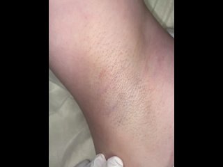 best видео от лазерная эпиляция массаж одинцовотрехгорка best