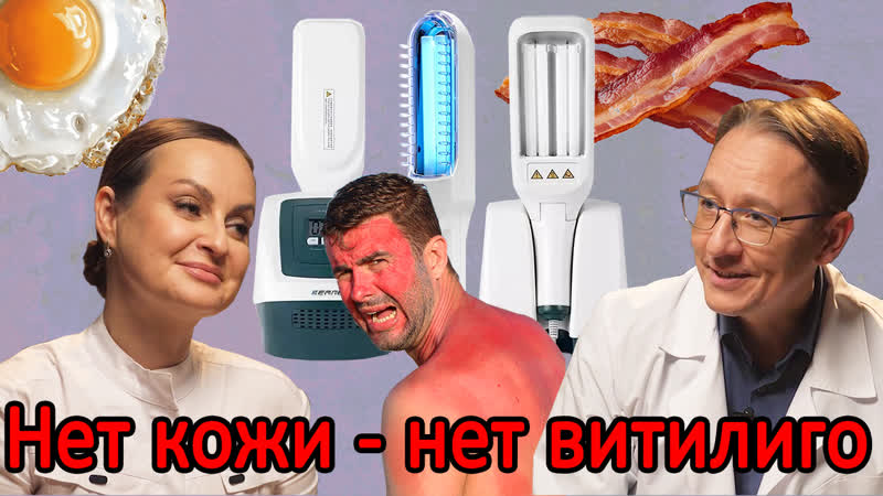 best обзор лампы 311 и лампы вуда облучаться или нет опасность рядом отзывы best