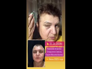 best отзыв на шампунь абсолют от атоми девчонки уже спросили это реально твои седые волосы best