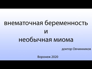 best внематочная беременность и необычная миома матки best