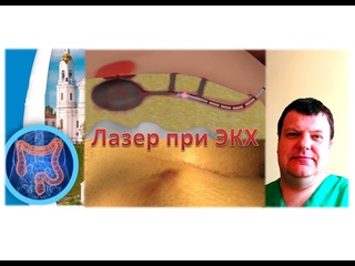 best лазерная операция эпителиальный копчиковый ход киста копчика экх пилонидальная болезнь best