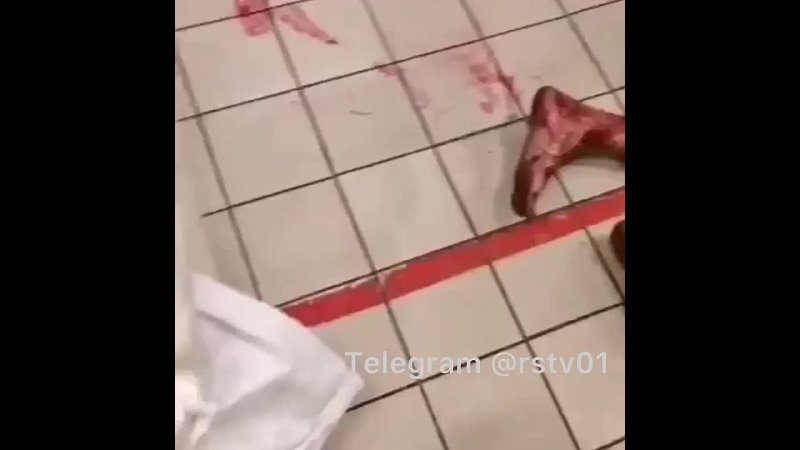 best в станице мечетинской бультерьер покусал своего хозяина в магазине best