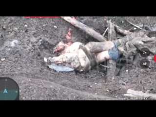 best страшные кадры с фронта украинский военный получил тяжелые ранения после артобстрела и находился в агонии в итоге best