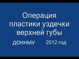 best операция пластики уздечки верхней губы френулопластика при диастеме молодые стоматология best