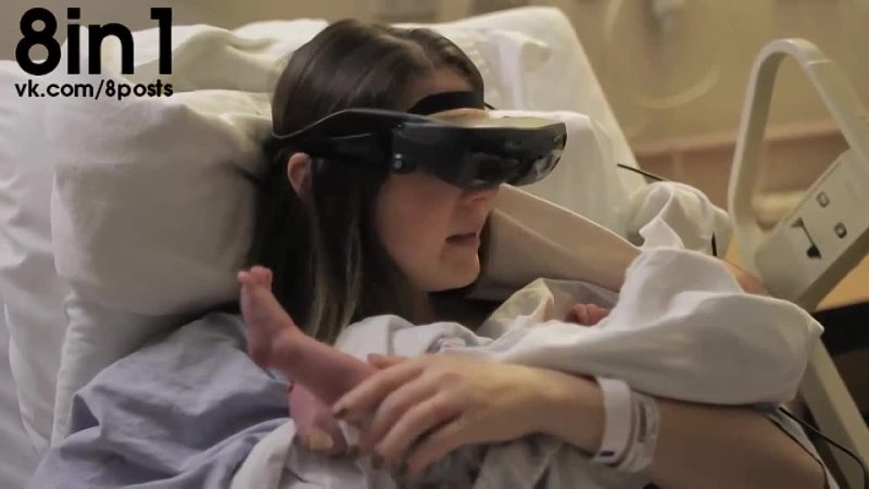 best слепая мама увидела своего ребёнка с помощью периферийных hd очков esights blind mother sees her baby best