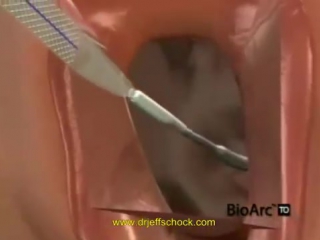 best bladder sling michigan urologist dr jeffrey schock ams tot best