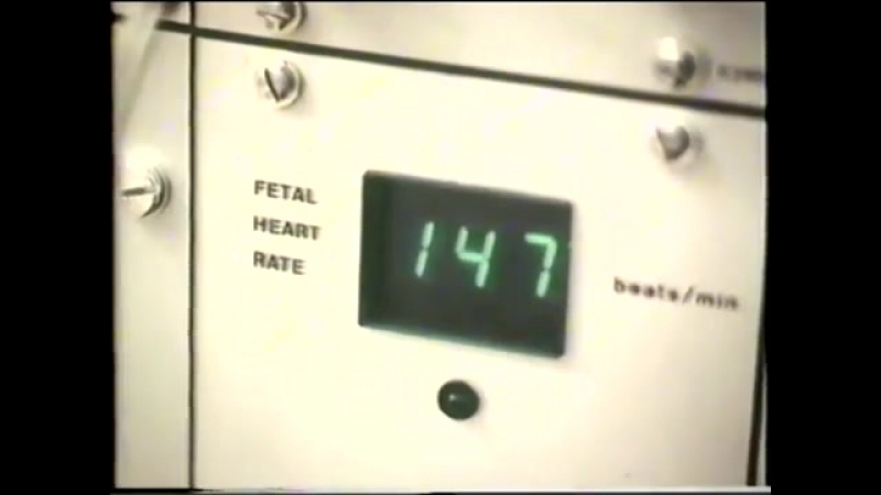 best ведение родов роды правильное ведение родов maintaining a normal childbirth best