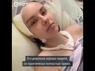 best пострадавшая во время протестов в минске уже месяц в больнице best