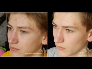 best результаты применения продукции jeunesse best