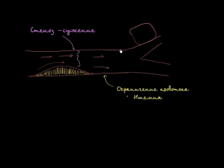 best стеноз ишемия и сердечная недостаточность best