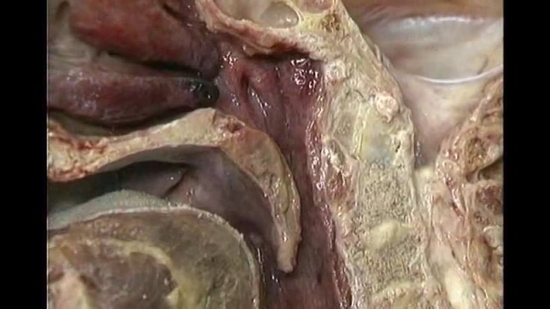 best dick aclands dvd atlas human anatomy 4of6 head and neck part 1 mp3 wogre best