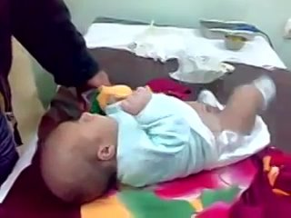 best как выглядит обрезание после обрезания равин слизывает молодые best