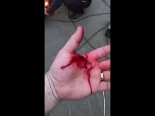 best сергей зарагулов у привитых частая причина смерти тромбоз и инфаркт mp4 best