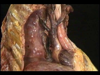 best porns aclands dvd atlas human anatomy 3of6 the trunk divx6 mp3 wogre best