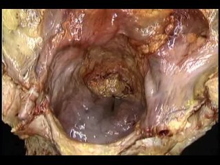 best anal aclands dvd atlas human anatomy 3of6 the trunk divx6 mp3 wogre best