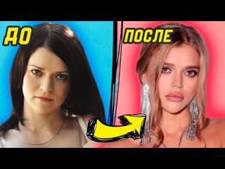 best эскортница рассказывает какие пластические операции она сделала для апгрейда внешности интимсити best