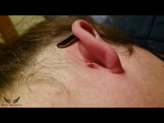best severe ear blackhead removal cystic acne treatment elderly pimple popping best